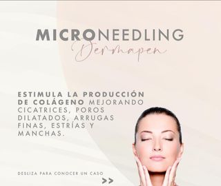 Tratamientos con DermaPen 