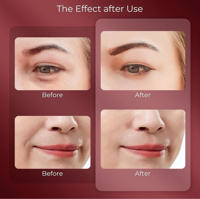 NUEVO - Masajeador Ocular