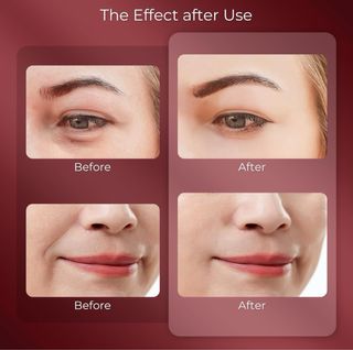 NUEVO - Masajeador Ocular