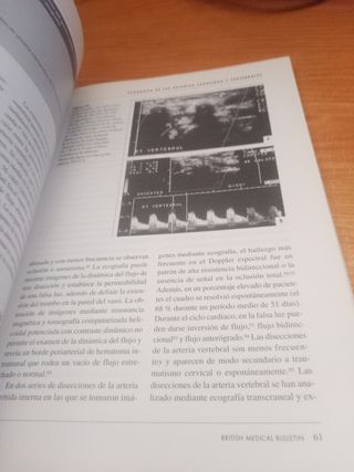 3x2 Accidente cerebrovascular