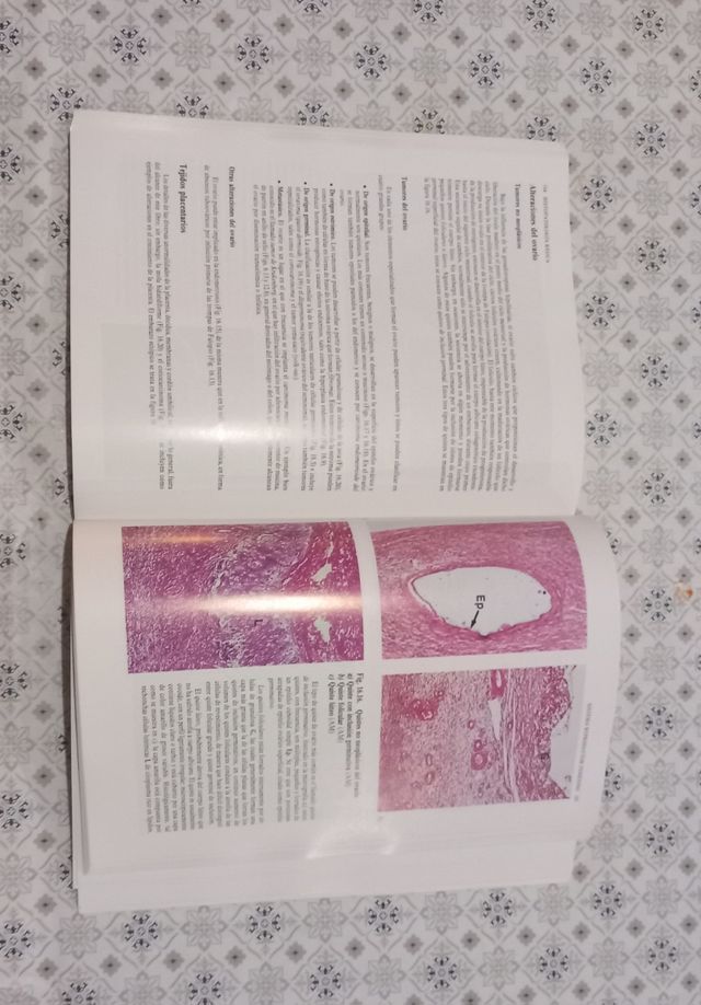 Histopatología Básica