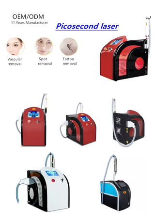 Láser Picosegundo - Eliminación de tatuajes