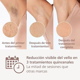Philips Lumea IPL 8000 - Depiladora philips Bri948