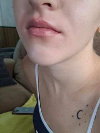 Hidratación de labios a domicilio 
