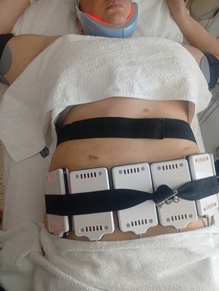 Sesiones de reducción de medidas 