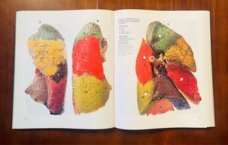 Atlas de anatomía humana