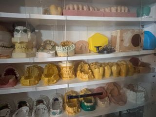 Modelli Dentali Esposizione