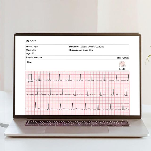 CkeckMe ECG Portátil - Pantalla Táctil NUEVO