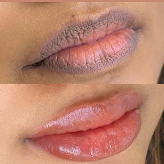 Neutralización de labios oscuros