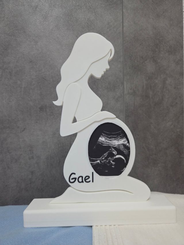 Marco de ecografía 3D personalizado