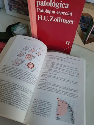 Lote 2 libros H.U. Zollinger: Anatomía Patológica 