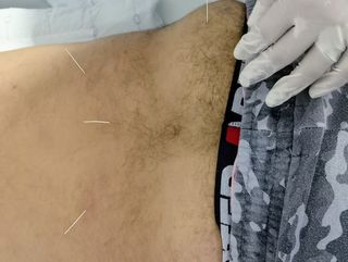 Fisioterapia Osteópatia Quiromasaje