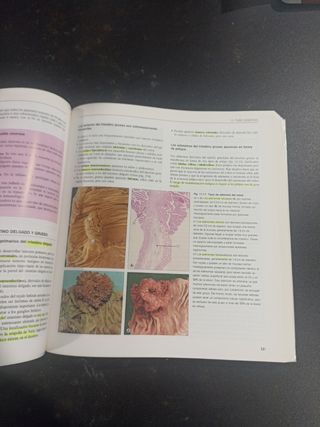 Anatomia Patologica (Spanish Edition)