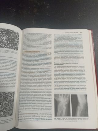 Anatomía Patologica