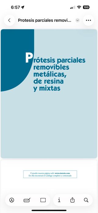 Prótesis Parciales Removibles