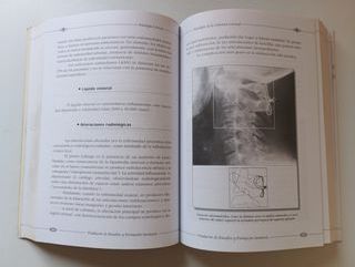 Patología de la columna cervical. Muy buen estado