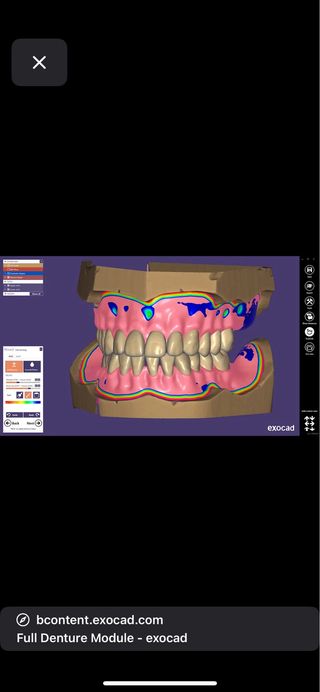 Installazione assistita exocad