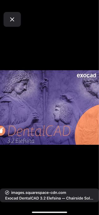 Installazione assistita exocad