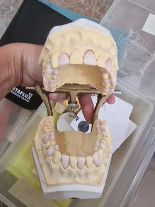grado superior tecnico protesis dental