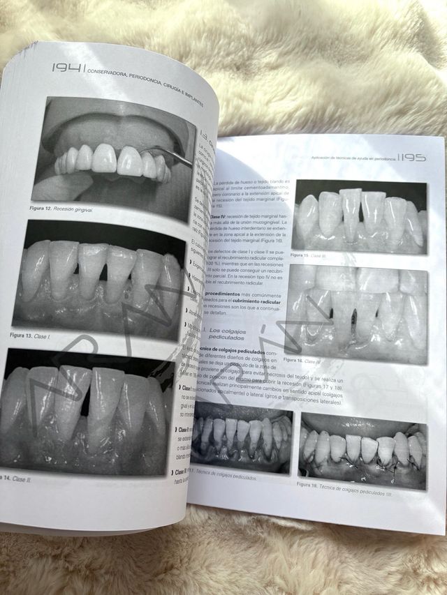 Conservadora, periodoncia, cirugía e implantes ...