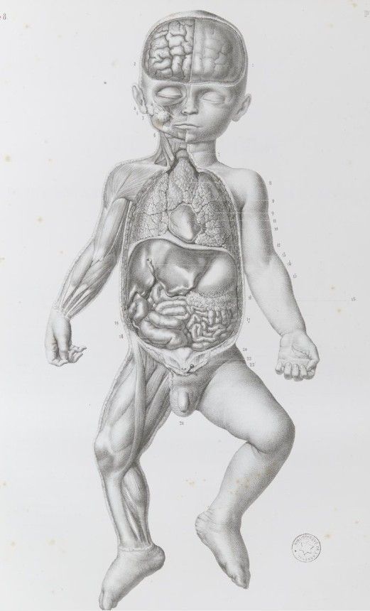 2 TOMOS 1878 Litografías Médicas Cuerpo Humano