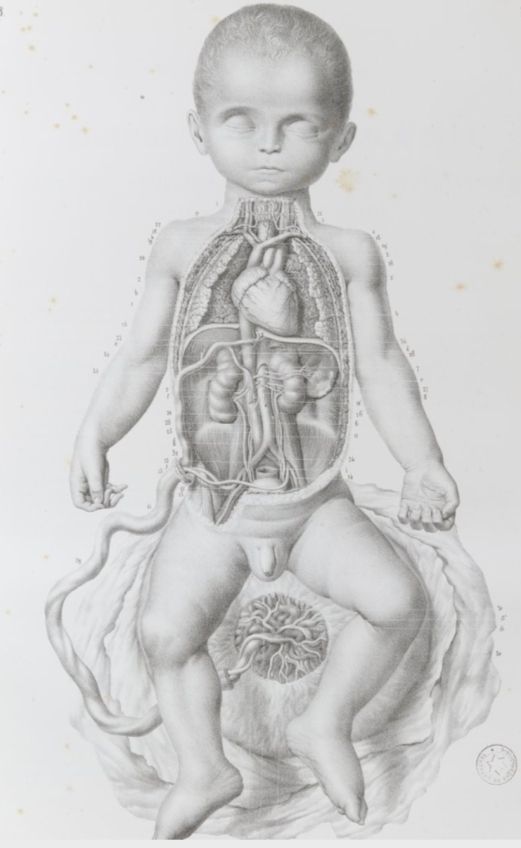 2 TOMOS 1878 Litografías Médicas Cuerpo Humano