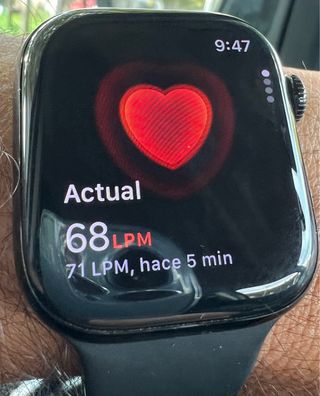 Apple Watch Series 10 