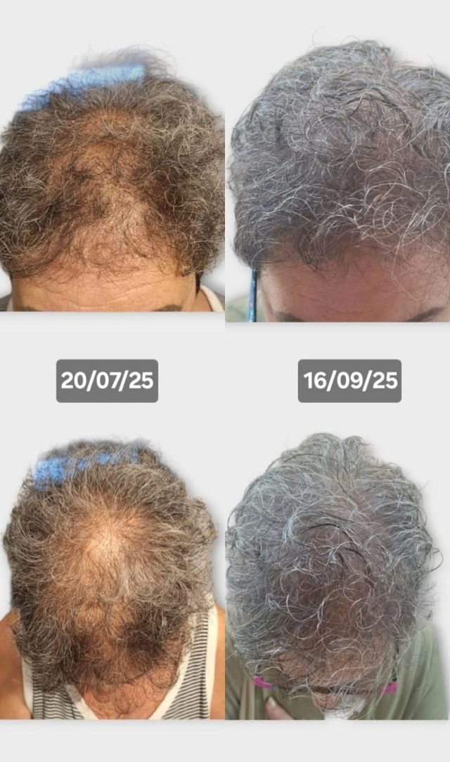 Aceite de Ajo Farmasi