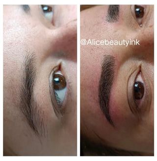  Micropigmentacion y Plasma para arrugas