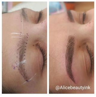  Micropigmentacion y Plasma para arrugas