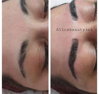  Micropigmentacion y Plasma para arrugas