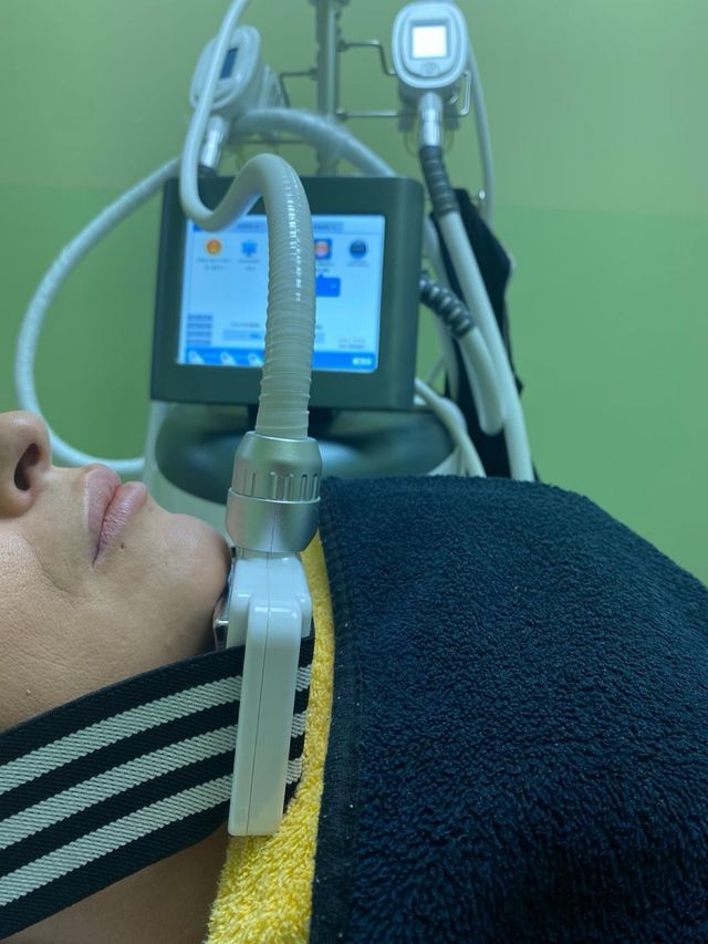 Maquina de Criolipólisis profesional.