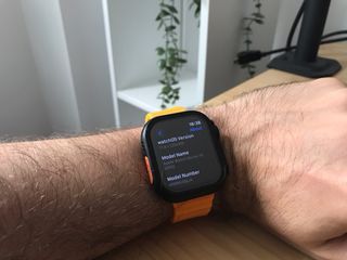Apple Watch Series 10 42mm Negro Azabache