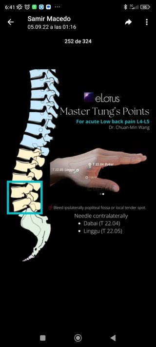 Osteopatía - quiromasaje -acupuntura -'natiropatia