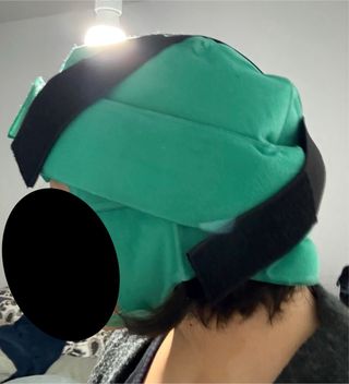 Casco crioterapia quimioterapia