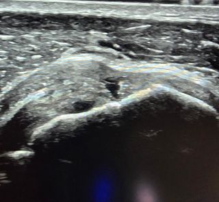 Ultrasonidos Logiq P9