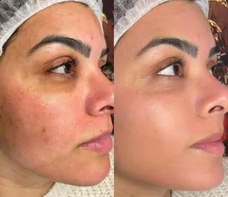 Pestañas, limpieza facial y mucho mas