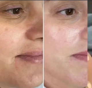 Pestañas, limpieza facial y mucho mas
