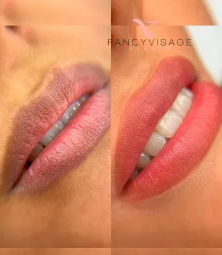 Micropigmención y Estética 