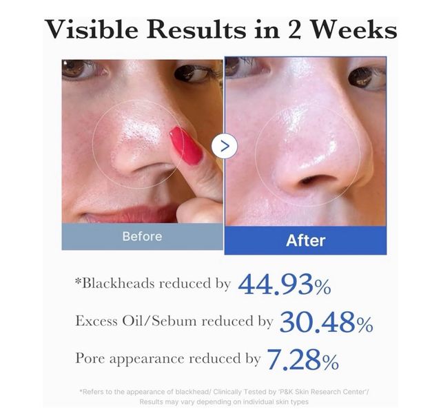 Medicube Zero Pore Pad AHA BHA