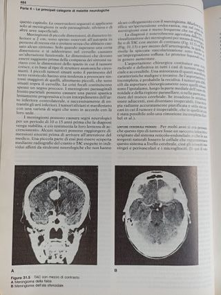 PRINCIPI DI NEUROLOGIA-R.D.ADAMS,M.VICTOR- Parte 4