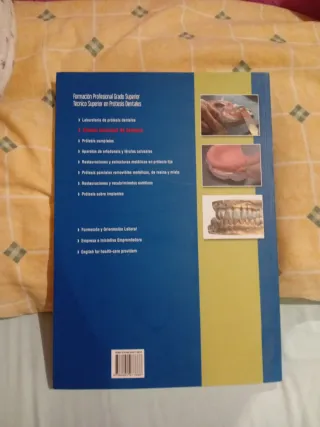 Diseño funcional de prótesis 