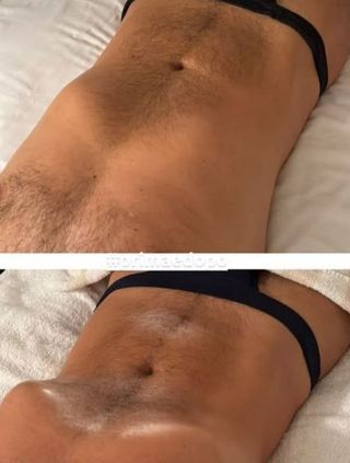 Quiromasaje terapeutico profesional NO EROTICO