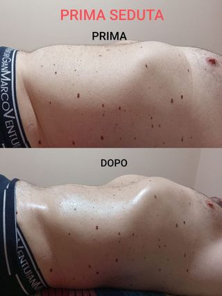 Quiromasaje terapeutico profesional NO EROTICO