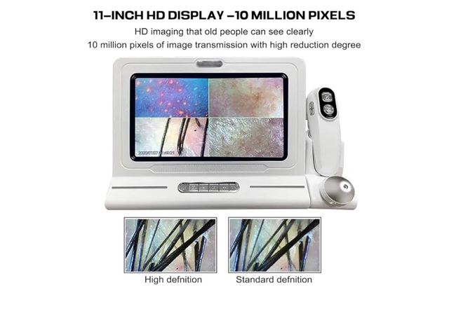 Analizador de piel y cabello HD 11