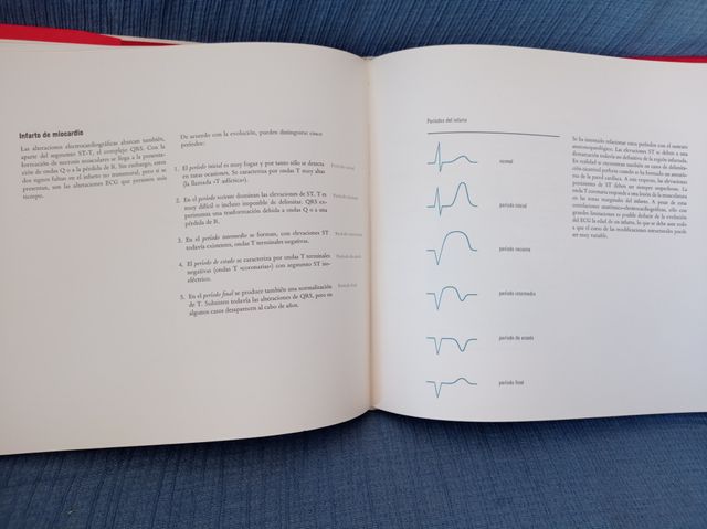 Síntomas guía cardíacos 