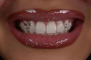 Aplicación de gemas dentales , 15 cada pieza 