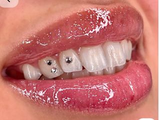 Aplicación de gemas dentales , 15 cada pieza 