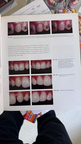 TIPS claves en odontologia