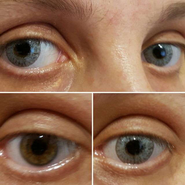 OFERTA Lentillas a 3€